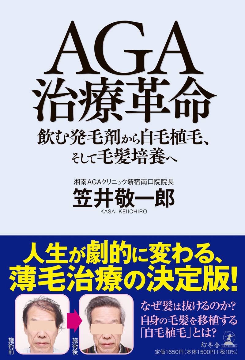 AGA治療革命 飲む発毛剤から自毛植毛、そして毛髪培養へ』笠井