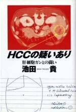 HCCの疑いあり 肝細胞ガンとの闘い